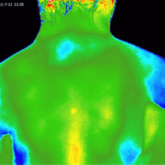 Elixir Mind Body Botanicals Relief After Thermal Image of Back after - Elixir Mind Body Boutique
