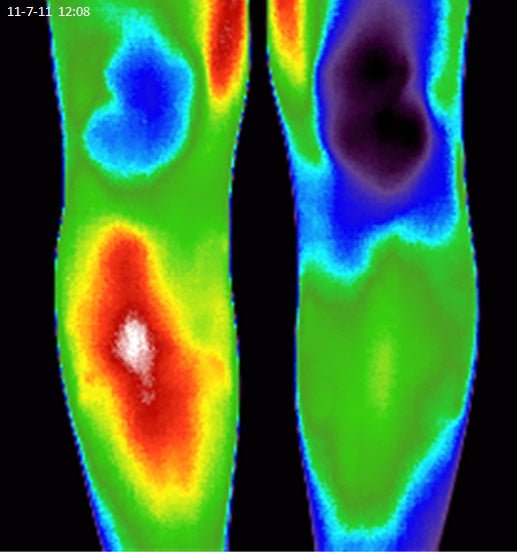 Thermal image of legs before and after using Elixir Mind Body Botanicals Relief Balm from Elixir Mind Body Boutique